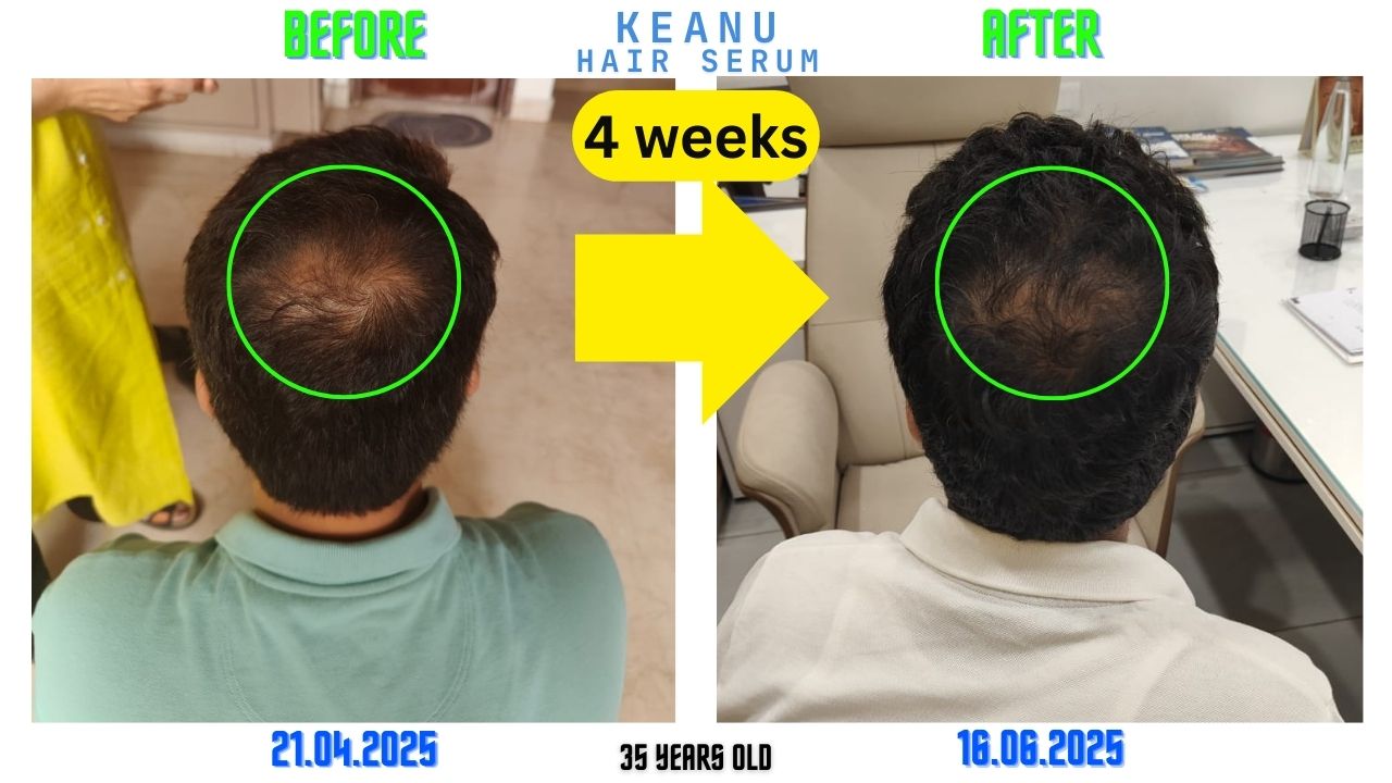Before and after top-view photographs from KEANU materials, dated 21 April and 16 June 2025